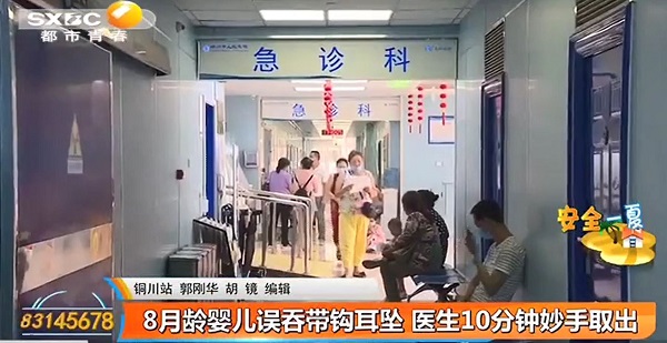 都市快報：8月齡嬰兒誤吞帶鉤耳墜 醫生10分鐘妙手取出